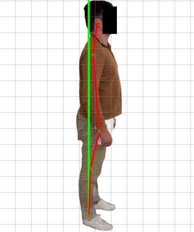 Après ajustements chiropratiques - Clinique de la colonne